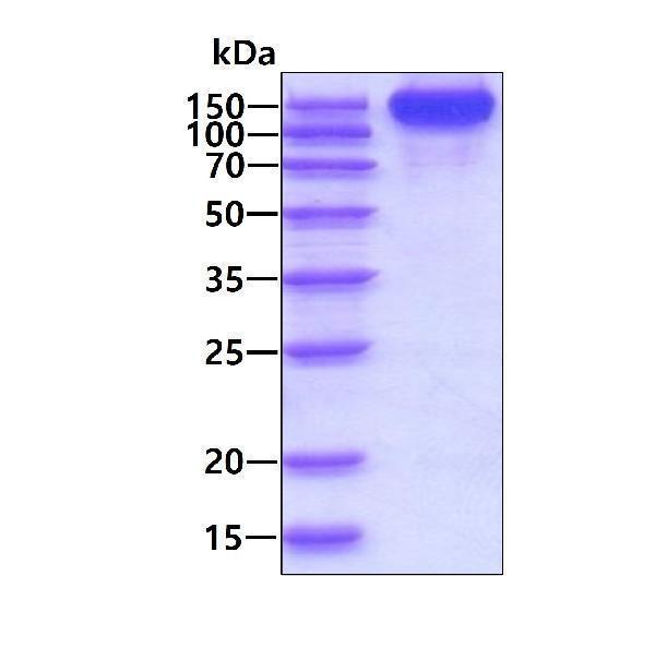 3ug by SDS-PAGE under reducing condition and visualized by coomassie blue stain