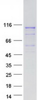 protq15345 lrrc41 human recombinant protein