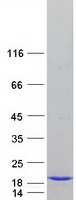 Coomassie blue staining of purified ELOB protein
