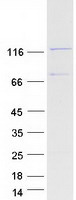 protq15431 scp1 sycp1 human recombinant protein