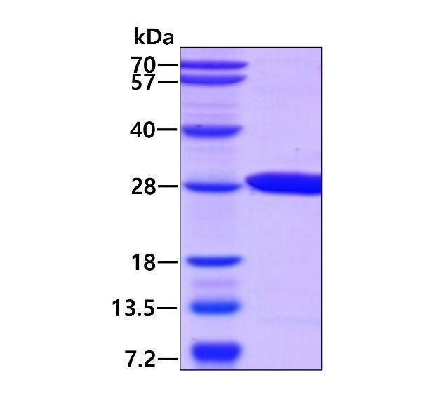 protq15526 sdspage human surf1 recombinant protein_1