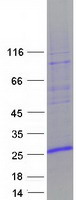 protq15649 znhit3 human recombinant protein
