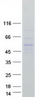 Coomassie blue staining of purified NFKBIB protein