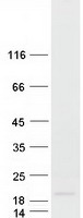 Coomassie blue staining of purified KISS1 protein