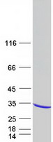 Coomassie blue staining of purified RAB30 protein