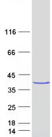 Coomassie blue staining of purified MPPED2 protein