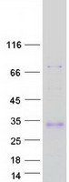 Coomassie blue staining of purified ADIPOQ protein