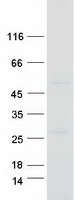 Coomassie blue staining of purified SEPTIN7 protein