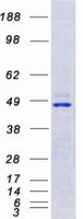 Coomassie blue staining of purified CAMK4 protein