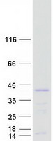 protq16637 gemin 1 smn2 human recombinant protein