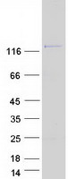 Coomassie blue staining of purified DGKD protein
