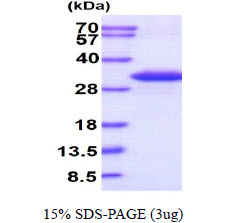 protq16775 sdspage human glyoxalase ii recombinant protein