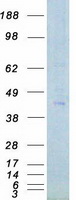 Coomassie blue staining of purified PHKG1 protein