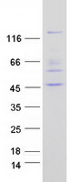 Coomassie blue staining of purified PTPN21 protein