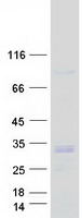 protq16854 deoxyguanosine kinase dguok human recombinant protein