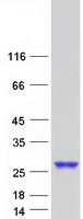 protq16890 tpd52l1 human recombinant protein