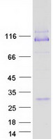 protq17r60 impg1 human recombinant protein