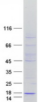 protq17rb0 rtl8b human recombinant protein
