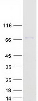 protq17rp2 tigd6 human recombinant protein