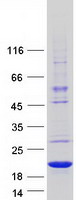protq1a5x7 whdc1l1 human recombinant protein