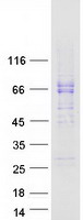 protq2m3c6 c15orf27 tmem266 human recombinant protein