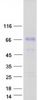 protq2mv58 tctn1 human recombinant protein