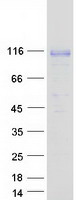 Coomassie blue staining of purified QRICH1 protein