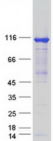 protq2tb90 hkdc1 human recombinant protein