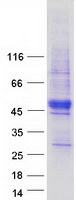 protq2tbc4 prickle4 human recombinant protein