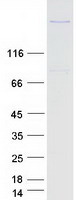 Coomassie blue staining of purified FER1L6 protein