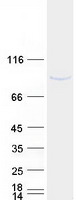 Coomassie blue staining of purified UVSSA protein