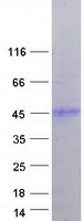 Coomassie blue staining of purified HFE protein