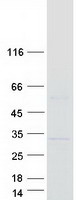Coomassie blue staining of purified MAJIN protein