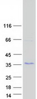 Coomassie blue staining of purified KRTAP27-1 protein