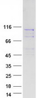 Coomassie blue staining of purified BBS9 protein