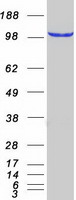 Coomassie blue staining of purified RABL6 protein