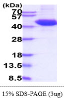 3ug by SDS-PAGE under reducing condition and visualized by coomassie blue stain