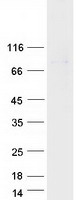 Coomassie blue staining of purified ZBED5 protein