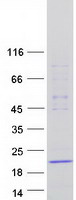 Coomassie blue staining of purified DNAL1 protein