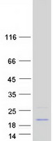 protq4vc31 ccdc58 human recombinant protein