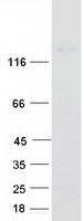 protq52lw3 arhgap29 human recombinant protein