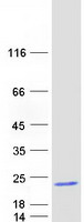 Coomassie blue staining of purified C14orf177 protein