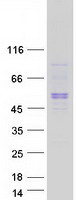 protq52wx2 sbk1 human recombinant protein