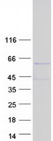 Coomassie blue staining of purified C17orf85 protein