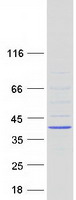 Coomassie blue staining of purified ZC2HC1C protein