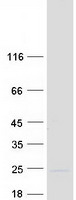 Coomassie blue staining of purified TMEM35A protein