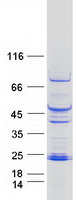 Coomassie blue staining of purified PHLDA2 protein