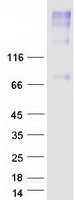 Coomassie blue staining of purified SLC44A4 protein
