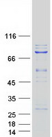 Coomassie blue staining of purified KLHL22 protein
