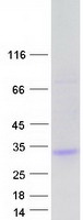 protq53hi1 unc50 human recombinant protein
